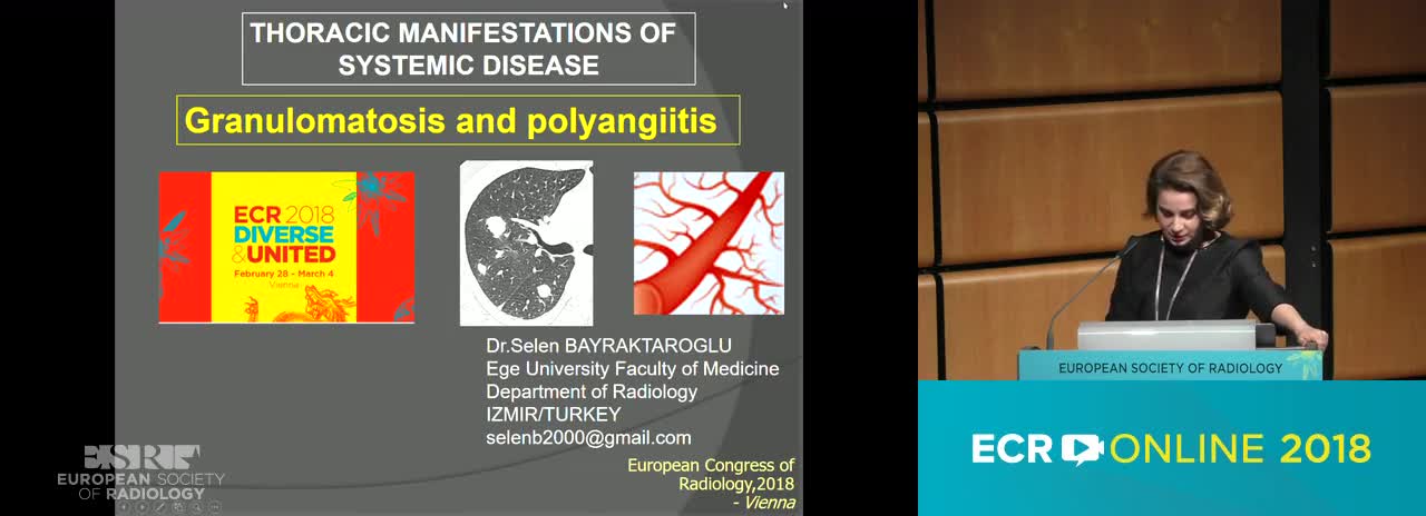 B. Granulomatosis and polyangiitis