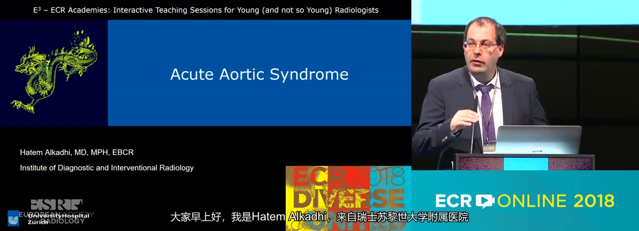 A. Acute aortic syndrome