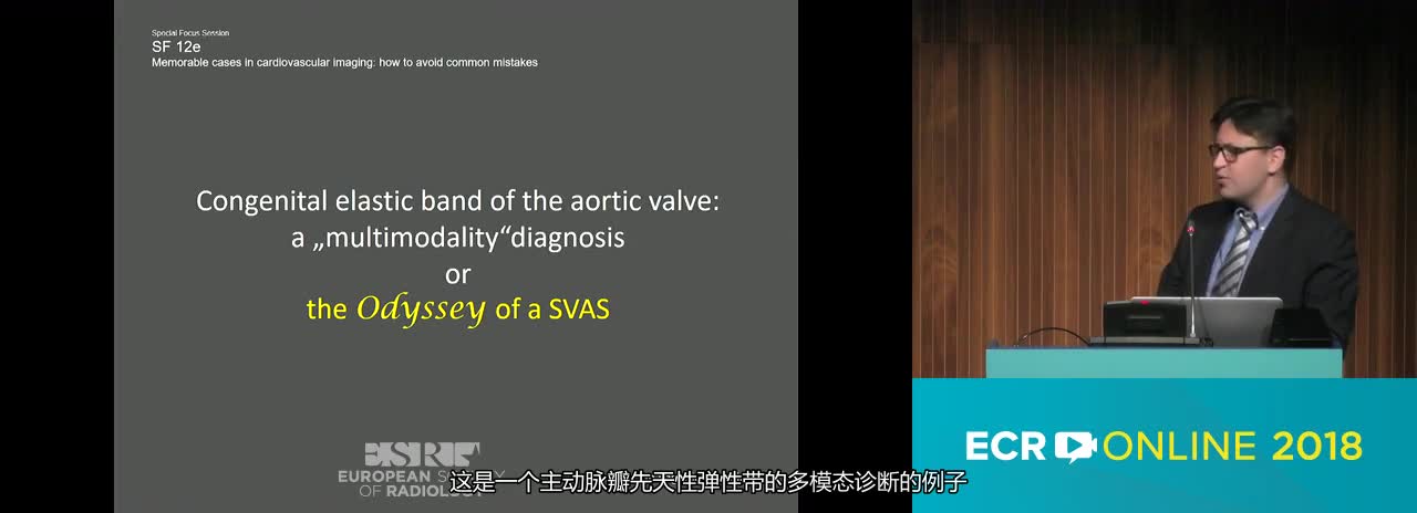 Congenital elastic band of the aortic valve: a 