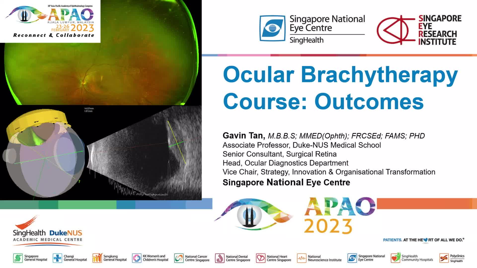 Ocular Oncology and Pathology - Outcomes