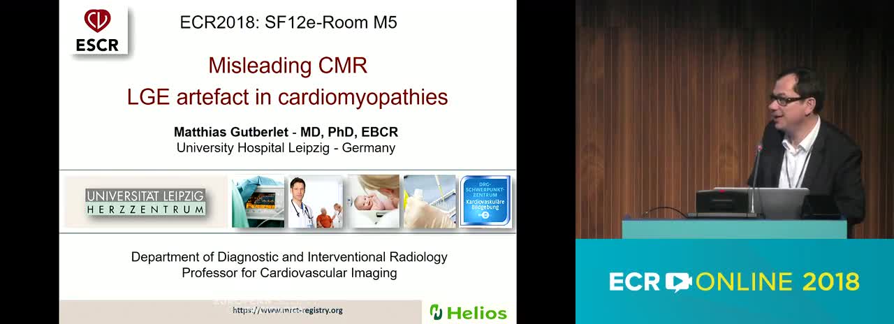 Misleading CMR LGE artefact in cardiomyopathies