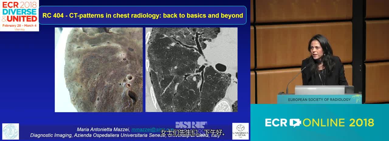 CT - patterns in chest radiology: back to basics and beyond---Chairperson’s introduction
